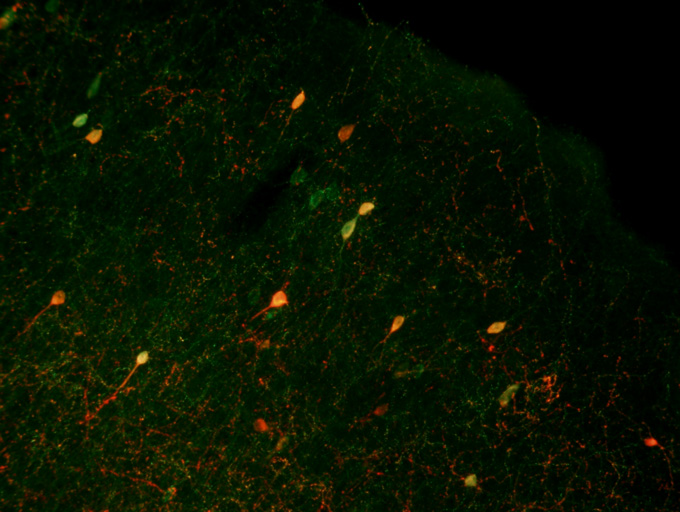 About CNS at UMass Amherst